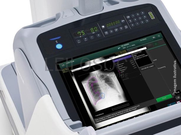 Braços para cadeiras